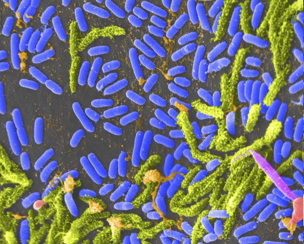 false color scanning microscope image of bacterial cells