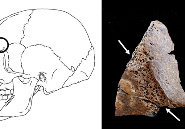 Side-by-side image showing a diagram of a human skull with a marked area and a photograph of a fossilized skull fragment with arrows pointing to specific features.